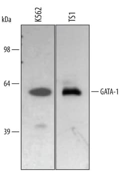 Human GATA-1 Antibody, R D Systems 25&mu;g; Unlabeled:Antibodies, Polyclonal
