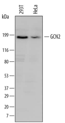 Human GCN2 Antibody, R D Systems 100ug; Unlabeled:Antibodies, Monoclonal