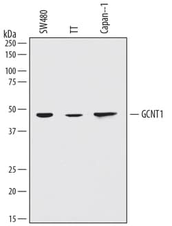 Human Glucosaminyl (N-acetyl) Transferase 1/GCNT1 Antibody, R D Systems