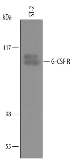 Mouse G-CSFR/CD114 Antibody, R D Systems 25&mu;g; Unlabeled:Antibodies,