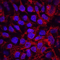 Human GDF-3 Antibody, R D Systems 100ug; Unlabeled:Antibodies, Monoclonal