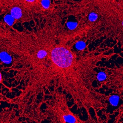 Human GFAP Antibody, R D Systems 100 &mu;g | Buy Online | R&D Systems | Fisher Scientific