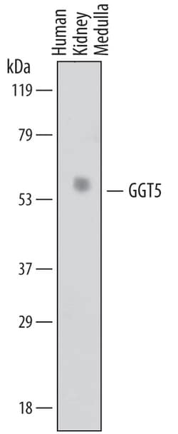 Human GGT5 Antibody, R D Systems 25&mu;g; Unlabeled:Antibodies, Polyclonal