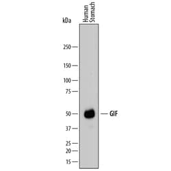 Human GIF Antibody, R D Systems 25&mu;g; Unlabeled:Antibodies, Polyclonal