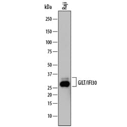Human GILT/IFI30 Antibody, R D Systems 25&mu;g; Unlabeled:Antibodies, Monoclonal