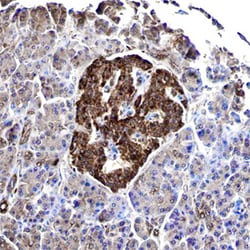 Human GIPR Antibody, R D Systems 100ug; Unlabeled:Antibodies, Monoclonal