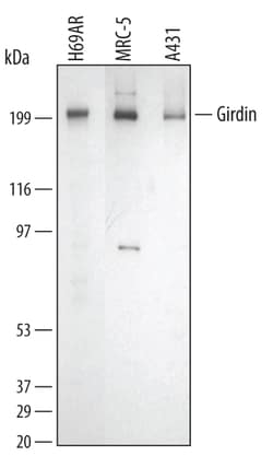 Human Girdin Antibody, R D Systems 100&mu;g; Unlabeled:Antibodies, Polyclonal
