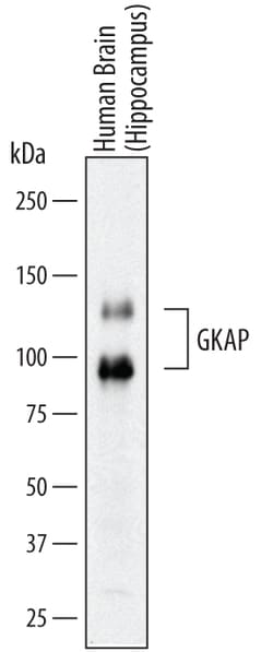 Human GKAP/DLGAP1 Antibody, R D Systems 25&mu;g; Unlabeled:Antibodies,