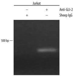 Human GLI-2 Antibody, R D Systems 25&mu;g; Unlabeled:Antibodies, Polyclonal