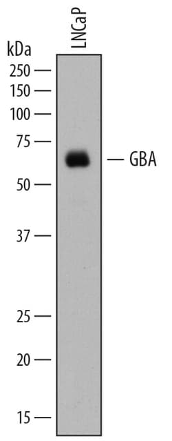 Human Glucosylceramidase/GBA Antibody, R D Systems 25&mu;g; Unlabeled:Antibodies,
