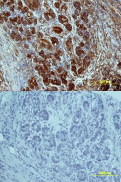 Human Glut2 Antibody, R D Systems 25&mu;g; Unlabeled:Anticuerpos