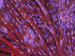 Rat Glut4 Antibody, R D Systems 200ug; Unlabeled:Antibodies, Monoclonal