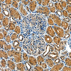 Human Glut4 Antibody, R D Systems 100&mu;g; Unlabeled:Antibodies, Monoclonal