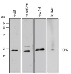Human/Mouse/Rat Glutathione Peroxidase 2/GPX2 Antibody, R D Systems 100ug;