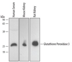 Human/Mouse/Rat Glutathione Peroxidase 3/GPX3 Antibody, R D Systems 100 &mu;g | Buy Online | R&D Systems | Fisher Scientific
