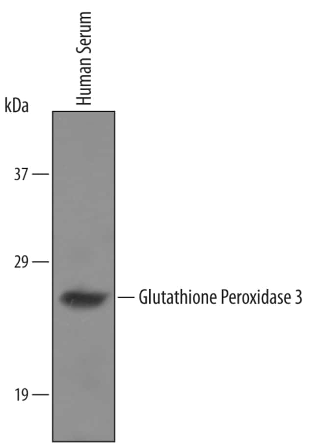 glutathione s-transferase gsts catalyze the conjugation of the reduced form Glutathione-Related Enzymes and Proteins: A Review