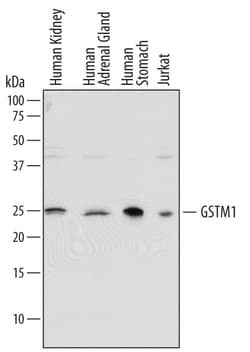 Human Glutathione S-Transferase mu 1/ GS Antibody, R D Systems 100&mu;g;