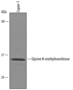 Human Glycine N-methyltransferase/GNMT Antibody, R D Systems 25&mu;g; Unlabeled:Antibodies,