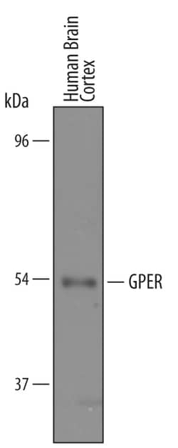 Human GPER/GPR30 Antibody, R D Systems 25&mu;g; Unlabeled:Antibodies, Polyclonal