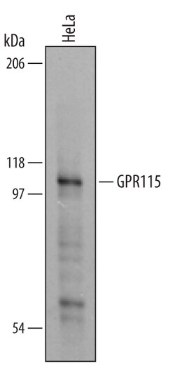 Human GPR115 Antibody, R D Systems 100 &mu;g | Buy Online | R&D Systems | Fisher Scientific