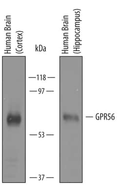 Human GPR56 Antibody, R D Systems 100&mu;g; Unlabeled:Antibodies, Polyclonal