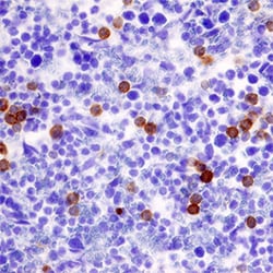 Mouse Ly-6G/Ly-6C (Gr-1) Antibody, R D Systems 25&mu;g; Unlabeled:Antibodies,