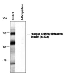 Human/Mouse/Rat Phospho-GRIN2B/NMDAR2B (Y1472) Antibody, R D Systems 100&mu;L;