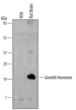 Rat Growth Hormone Antibody, R D Systems 25&mu;g; Unlabeled:Antibodies,
