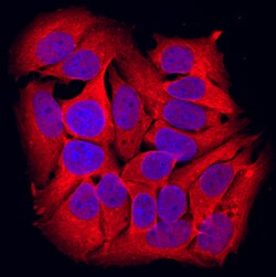 Human GSK-3 alpha Antibody, R D Systems 25&mu;g; Unlabeled:Antibodies,