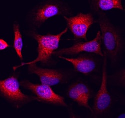 Human/Mouse/Rat GSK-3 alpha/beta Antibody, R D Systems 25&mu;g; Unlabeled:Antibodies,