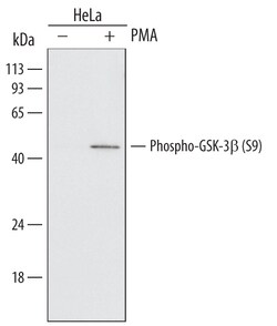 Human Phospho-GSK-3 beta (S9) Antibody, R D Systems 25&mu;g; Unlabeled:Antibodies,