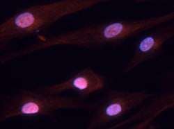 Hairless Goat anti-Human, Polyclonal, R D Systems 25&mu;g; Unlabeled, Quantity: