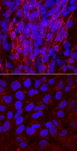 Human HCN4 Antibody, R D Systems 100&mu;g; Unlabeled:Antibodies, Polyclonal
