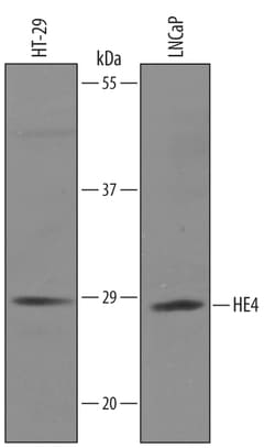 Human HE4/WFDC2 Antibody, R D Systems 100&mu;g; Unlabeled:Antibodies, Polyclonal