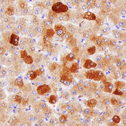 Human Hepsin Antibody, R D Systems 25&mu;g; Unlabeled:Antibodies, Monoclonal