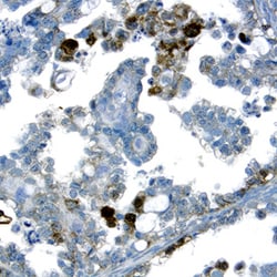 Human HES-1 Antibody, R D Systems 25&mu;g; Unlabeled:Antibodies, Polyclonal