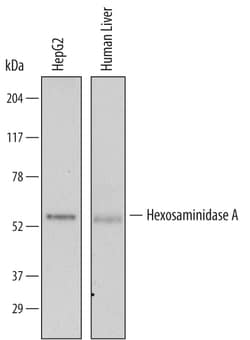 Human Hexosaminidase A/HEXA Antibody, R D Systems 100 &mu;g | Buy Online | R&D Systems | Fisher Scientific
