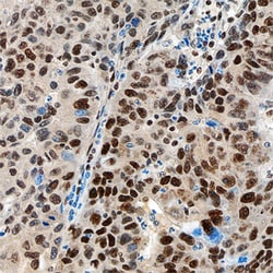 Human Hexim 1 Antibody, R D Systems 25&mu;g; Unlabeled:Antibodies, Polyclonal