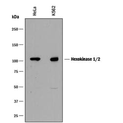 Human Hexokinase 1/2 Antibody, R D Systems 25&mu;g; Unlabeled:Antibodies,