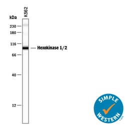 Human Hexokinase 1/2 Antibody, R D Systems 25&mu;g; Unlabeled:Antibodies,