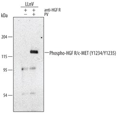 Human/Mouse Phospho-HGFR/c-MET (Y1234/Y1235) Antibody, R D Systems 50 &mu;g | Buy Online | R&D Systems | Fisher Scientific