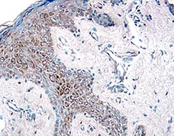 Human HGFR/c-MET Antibody, R D Systems 25&mu;g; Unlabeled:Antibodies, Polyclonal
