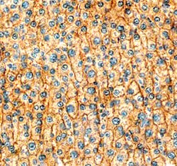 Human HGFR/c-MET Antibody, R D Systems 25&mu;g; Unlabeled:Antibodies, Polyclonal
