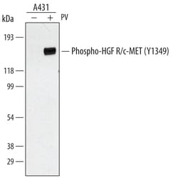 Human/Mouse Phospho-HGFR/c-MET (Y1349) Antibody, R D Systems 50&mu;g; Unlabeled:Antibodies,