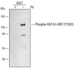 Human Phospho-HGFR/c-MET (Y1003) Antibody, R D Systems 100 &mu;g | Buy Online | R&D Systems | Fisher Scientific