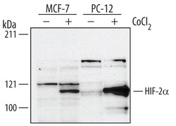 Human/Rat HIF-2 alpha/EPAS1 Antibody, R D Systems 100&mu;g; Unlabeled:Antibodies,