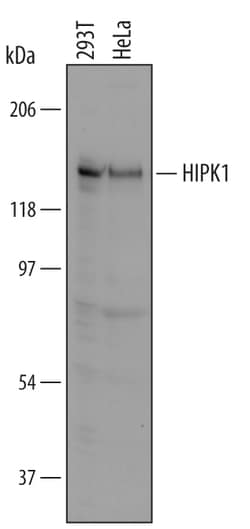 Human HIPK1 Antibody, R D Systems 25&mu;g; Unlabeled:Antibodies, Polyclonal