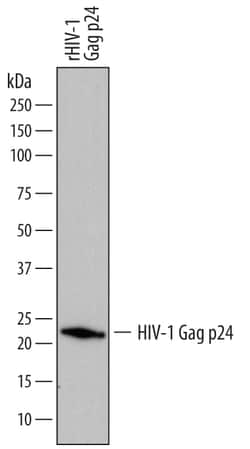 HIV-1 Gag p24 Antibody, R D Systems 25 &mu;g | Buy Online | R&D Systems | Fisher Scientific
