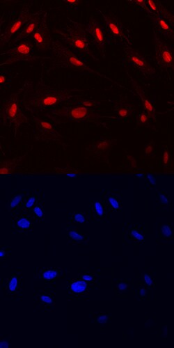 Human HMGB1/HMG-1 Antibody, R D Systems 100&mu;g; Unlabeled:Antibodies,
