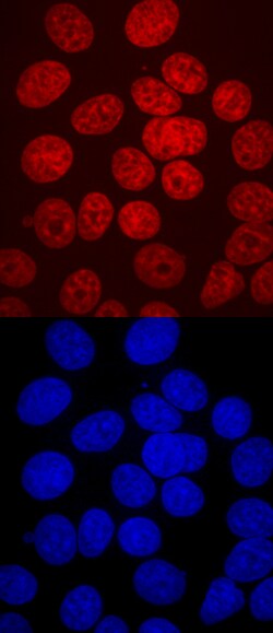 Human HNF-3 alpha/FoxA1 Antibody, R D Systems 100ug; Unlabeled:Antibodies,